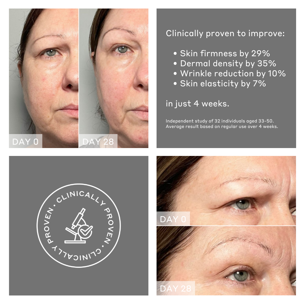 Face Rocket® Dispositivo facial 5-en-1 para firmeza y tonificación