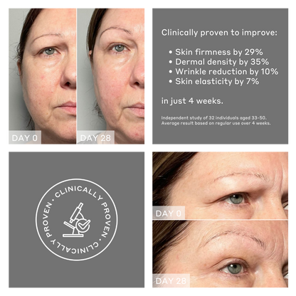Face Rocket® Dispositivo facial 5-en-1 para firmeza y tonificación