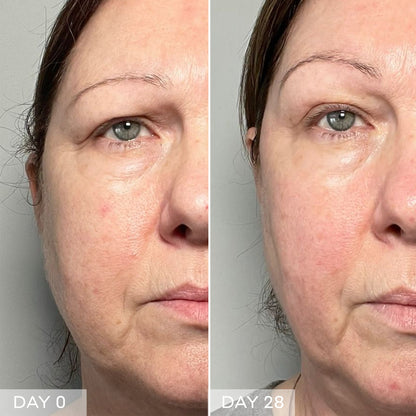 Face Rocket® Dispositivo facial 5-en-1 para firmeza y tonificación