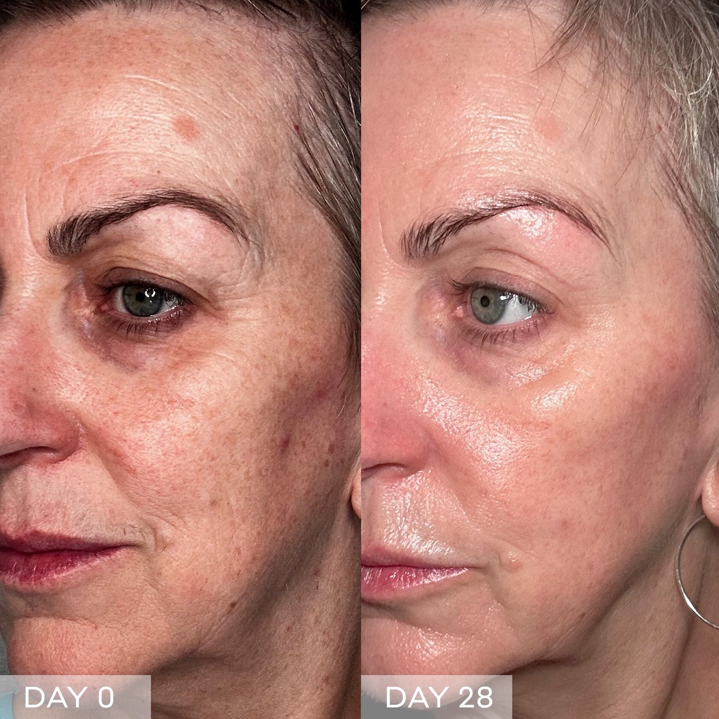 Face Rocket® Dispositivo facial 5-en-1 para firmeza y tonificación