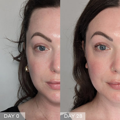 Face Rocket® Dispositivo facial 5-en-1 para firmeza y tonificación